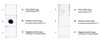 Tau (pThr217) Antibody