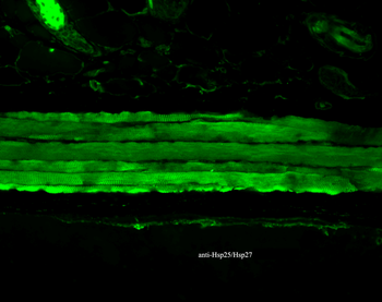 HSP27 Antibody (FITC)