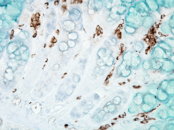 DNA Damage Antibody (APC)