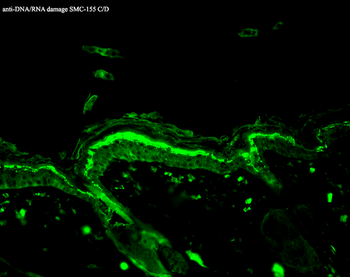 DNA Damage Antibody (APC)