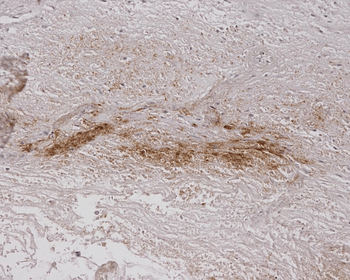 Alginate Antibody (RPE)