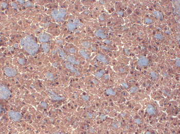 GABA A Receptor Antibody (APC)