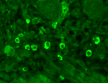 GABA A Receptor Antibody (FITC)