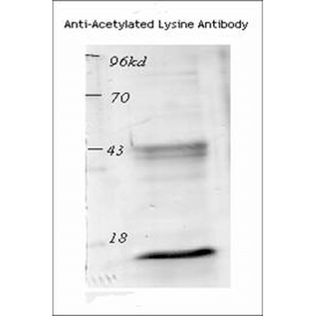 Acetylated Lysine Antibody (PerCP)