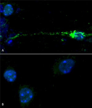 Alpha Synuclein Pre-formed Fibrils (Type 1)