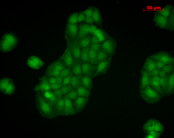 Calnexin-CT Antibody