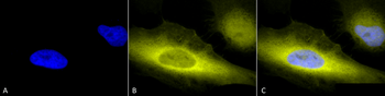 Ubiquitin Antibody