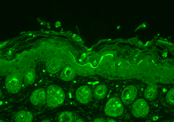 Ubiquitin Antibody