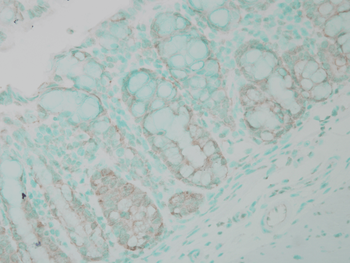 Ubiquitin Antibody
