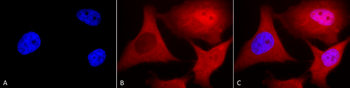 Ubiquitin Antibody