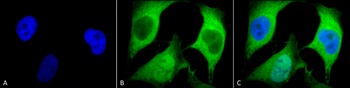 Ubiquitin Antibody