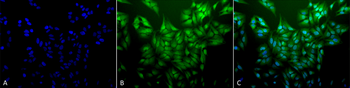 Ubiquitin Antibody