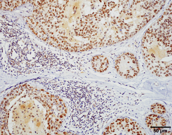 HSF1 Antibody