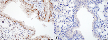 HSF1 Antibody