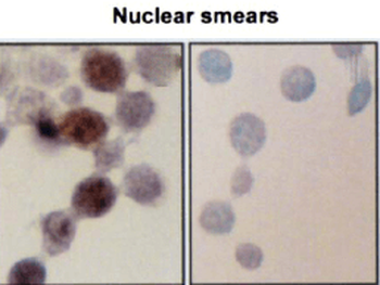 HSP70/HSC70 Antibody