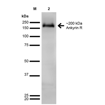 Ankyrin R Antibody (APC)