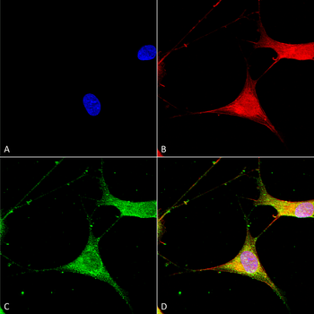 Kir6.1 Antibody (APC)
