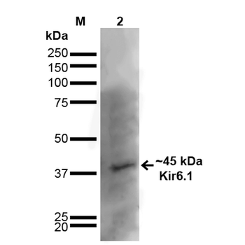 Kir6.1 Antibody (APC)