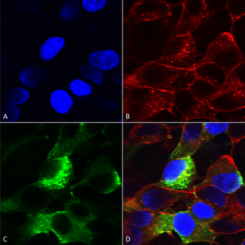 NaVbeta3 Antibody (APC)