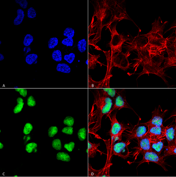 Choline Acetyltransferase Antibody (APC)