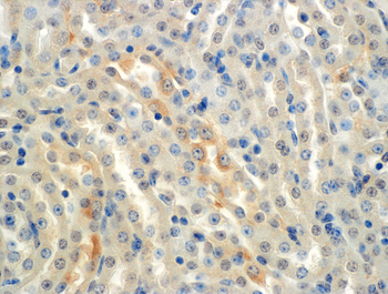 ENaC alpha Antibody (PerCP)