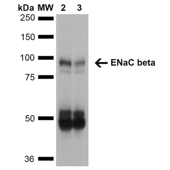 ENaC beta Antibody (Biotin)