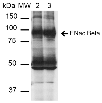ENaC beta Antibody (Biotin)