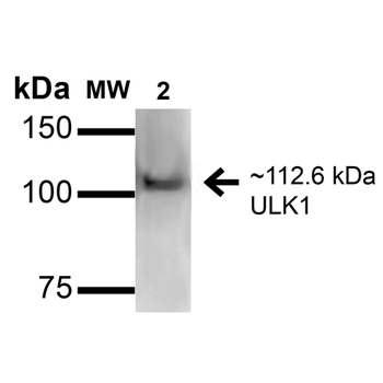 ULK1 Antibody