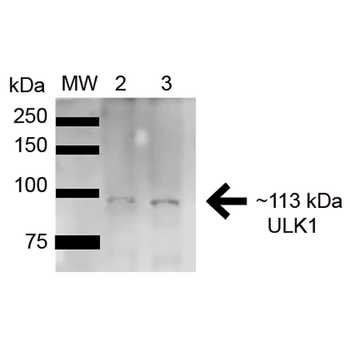 ULK1 Antibody (HRP)