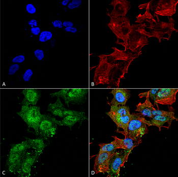 Calcium Sensing Receptor Antibody (HRP)