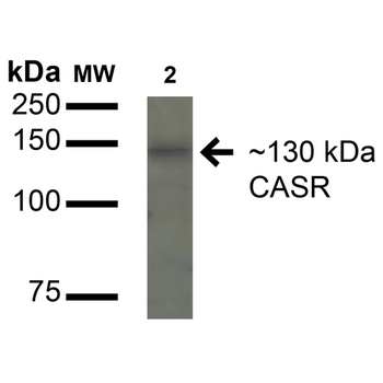 Calcium Sensing Receptor Antibody (HRP)