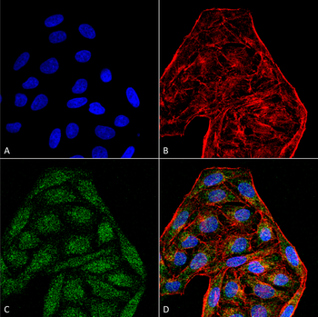 CD74 Antibody (RPE)