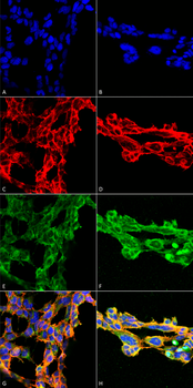7-Ketocholesterol Antibody (APC)