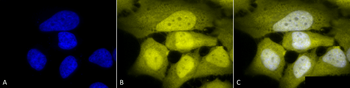 Phosphoserine Antibody (Biotin)