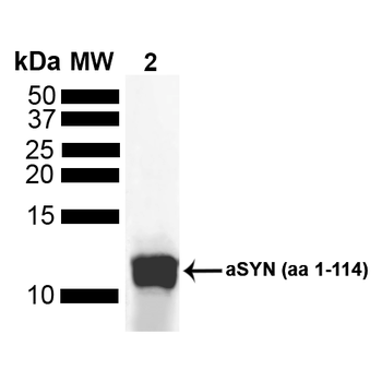 Alpha Synuclein Antibody (RPE)