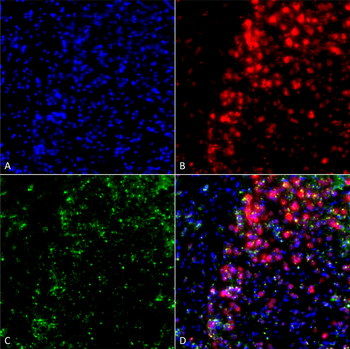 Alpha Synuclein Antibody