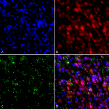Alpha Synuclein Antibody