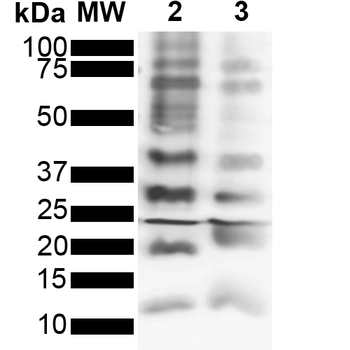 Ubiquitin Antibody