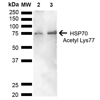 HSP70 (Acetyl Lys77) Antibody (HRP)