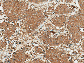 ROR1 Antibody (APC)