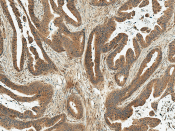MDM2 Antibody (RPE)