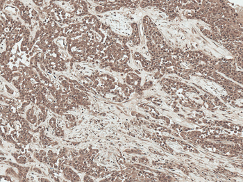 SFRP2 Antibody: RPE