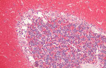 Alpha Synuclein Antibody