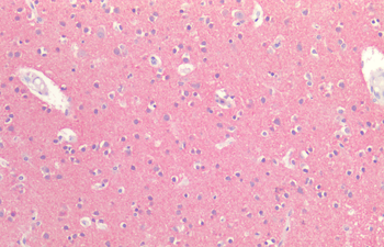 Tau Antibody (APC)