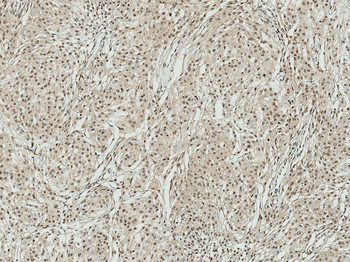 ATG7 Antibody