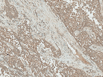 IGF-1 Antibody (APC)