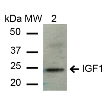 IGF-1 Antibody (FITC)