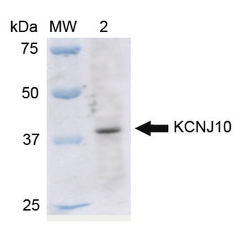 Kir4.1 Antibody (APC)