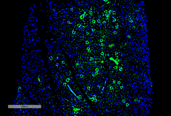 parvalbumin Antibody (Biotin)