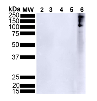 Alpha Synuclein Antibody (pSer129): APC